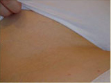 Laser?  Light Treatment?  Electrolysis?  Infra red? | Femme Clinic